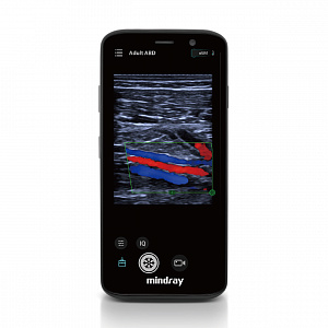 ����������� �������������� ������  Mindray TE Air e5M