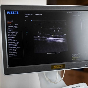 Стационарная цифровая ультразвуковая диагностическая система с цветным допплером SIUI Apogee 3500