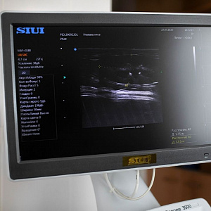       SIUI Apogee 3500