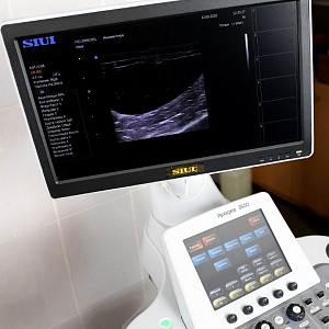       SIUI Apogee 3500